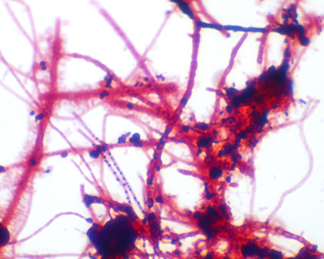 Filamentous Bacteria - Chemtron Riverbend Wastewater Systems